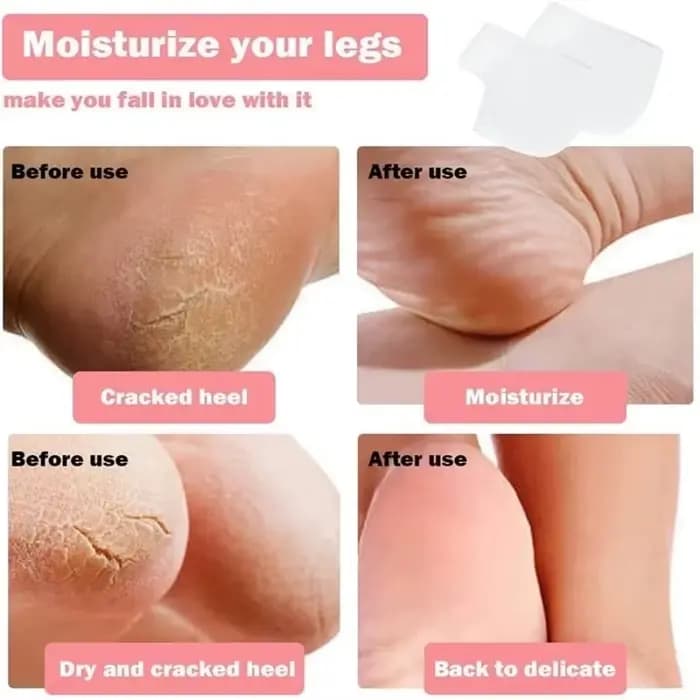 Protections de talon en gel de silicone